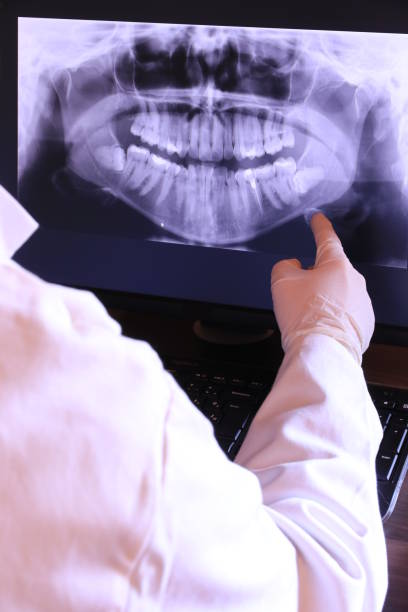 Best Emergency Treatment for Dental Infections or Abscesses in Keller, TX
