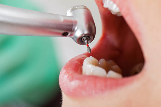 Best Emergency TMJ Treatment in Keller, TX